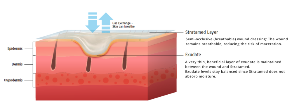 Stratamed Mode of action